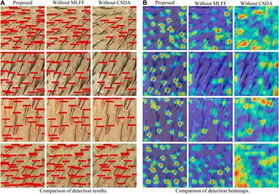 Hair cluster detection model based on dermoscopic images